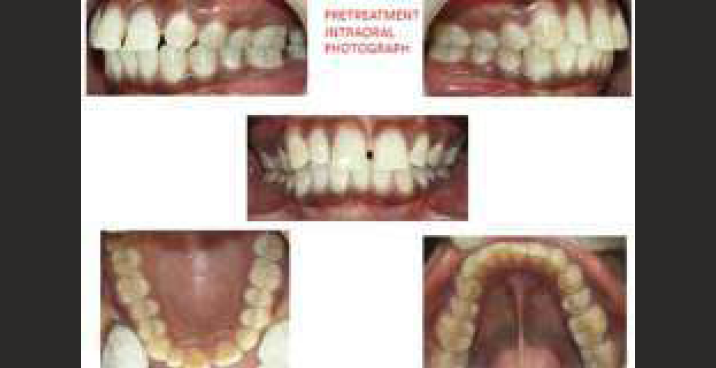 Pre-treatment photograph without extraction