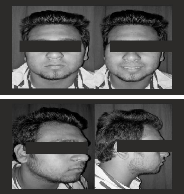 Pre-treatment extra-oral photographs