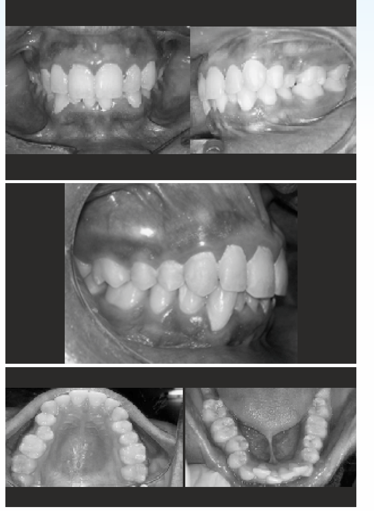 Pre-treatment intra-oral photographs