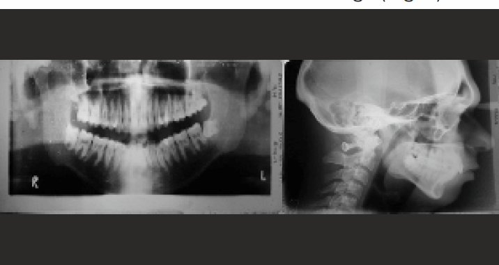 Pre-treatment radiographs