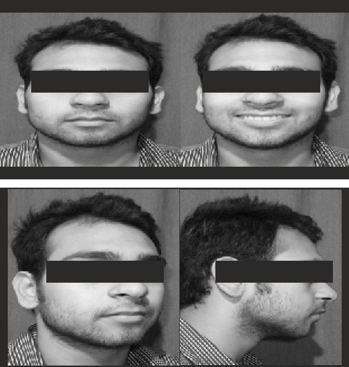 Post-treatment extra-oral photographs