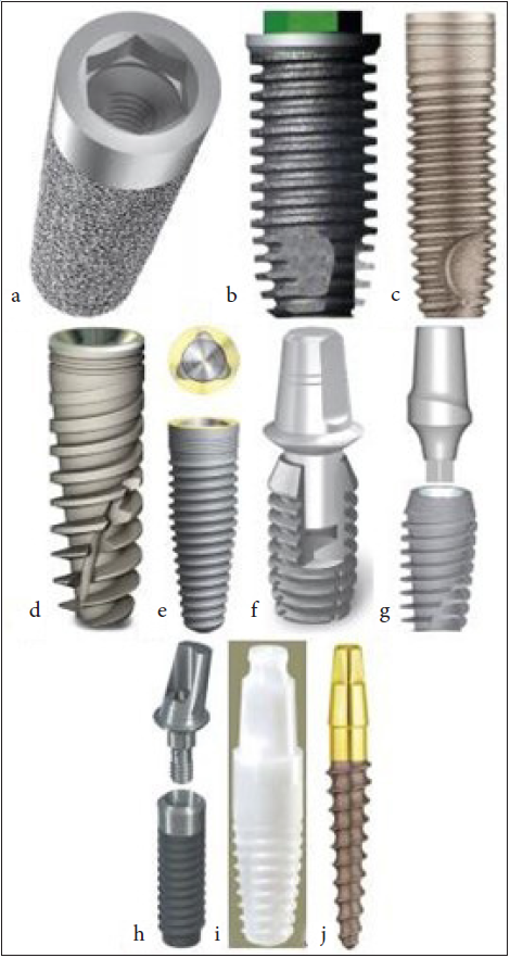 Different Implant Design. (a) - Non-threaded implant of Endopore system with hexagonal internal connection. (b) - Threaded implant with square threads and hexagonal external connection. (c) - Parallel body design with self-tapping thread design from Alpha Bio. (d) - Tapered body with variable thread design. (e) - Tapered implant from Nobel Biocare with triangular internal connection. (f) - Tapered internal connection implant. (g) - Taper internal connection. (h) - Soft tissue–level single-stage implant from Straumann. (i) - White sky zirconium implant. (j) - One-piece implant