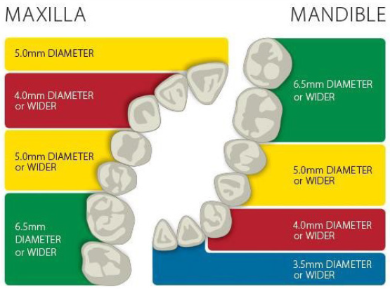 Abutment Diameter Selection Guide for Non-Shouldered Abutments. *The chart above contains recommendations only. Actual clinical conditions and the clinician’s assessment of the patient should be the main criteria for choosing the size of the implant.