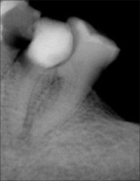 Pre-operative radiograph with regards to 36