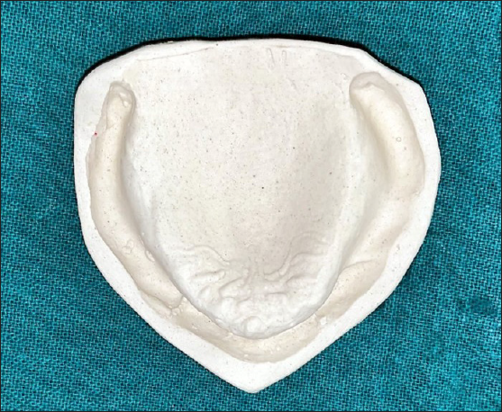 Preliminary maxillary cast.